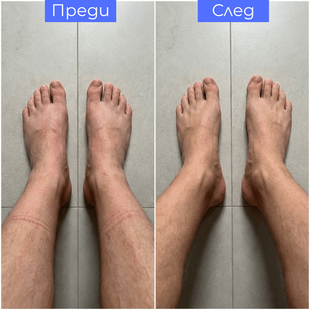 KOMPREA Компресивни чорапи за енергия, комфорт и облекчение през целия ден