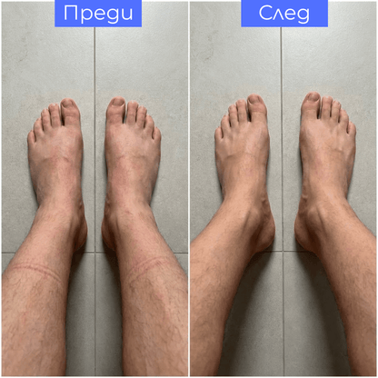 KOMPREA Компресивни чорапи за енергия, комфорт и облекчение през целия ден